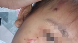 Miris! Art Di Bawah Umur Diduga Jadi Korban Kekerasan Istri Prajurit TNI di Depok