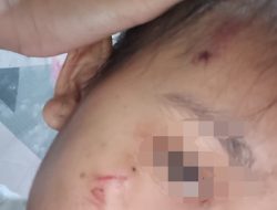 Miris! Art Di Bawah Umur Diduga Jadi Korban Kekerasan Istri Prajurit TNI di Depok